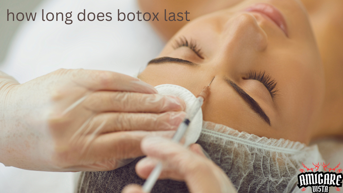 A medical professional administering a Botox injection to a person's forehead, illustrating the process of Botox treatment. Text overlay asks, 'how long does botox last?